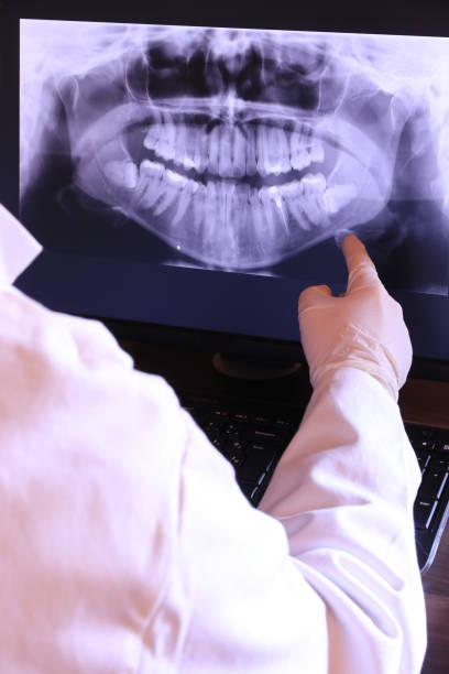 Best Emergency Root Canal Treatment in Alamae, NC
